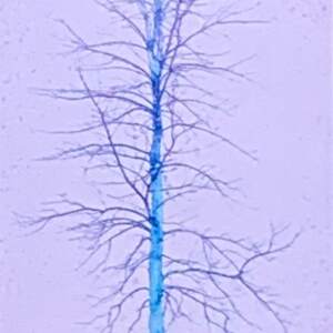 Solitaire Mauve, mixed media tree painting by Lori Bagneres | Effusion Art Gallery + Cast Glass Studio, Invermere BC