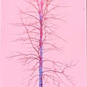 Solitaire Pink, mixed media tree painting by Lori Bagneres | Effusion Art Gallery + Cast Glass Studio, Invermere BC